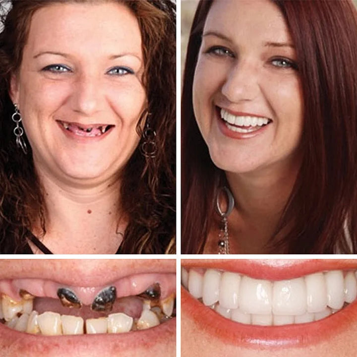 🏆 2026 Top Rated⏰Owiwell™ Medical Full Denture with Strong Suctiond