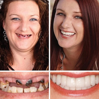 🏆 2026 Top Rated⏰Owiwell™ Medical Full Denture with Strong Suctiond