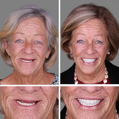 🏆 2026 Top Rated⏰Owiwell™ Medical Full Denture with Strong Suctiond