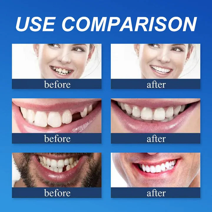 🏆 2026 Top Rated⏰Owiwell™ Medical Full Denture with Strong Suctiond