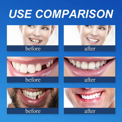 🏆 2026 Top Rated⏰Owiwell™ Medical Full Denture with Strong Suctiond