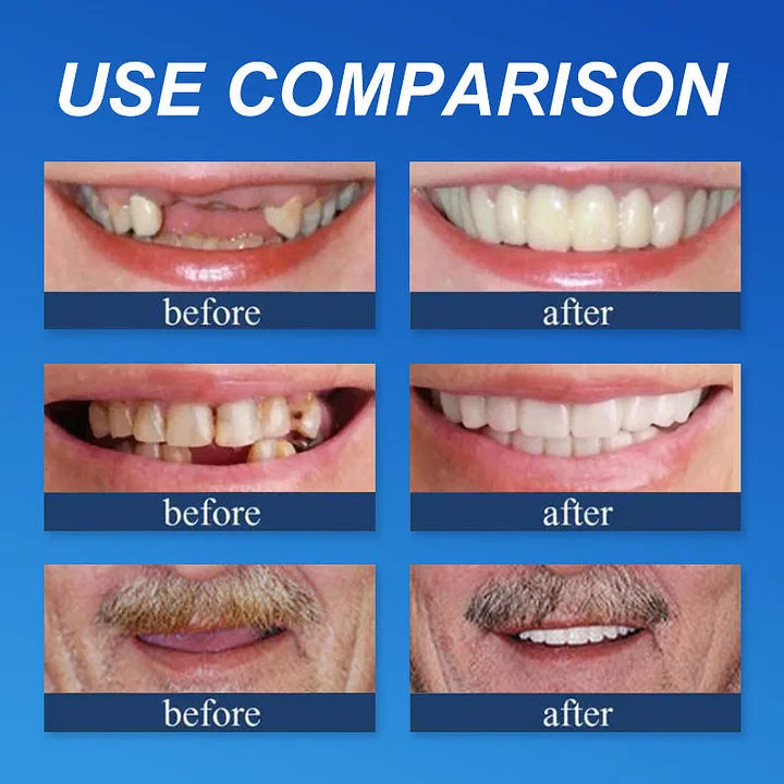🏆 2026 Top Rated⏰Owiwell™ Medical Full Denture with Strong Suctiond